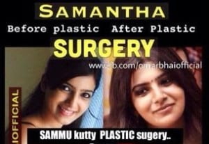 Samantha Plastic Surgery Before vs After